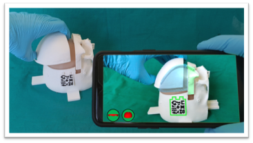 Smartphone app to guide open cranial vault remodeling