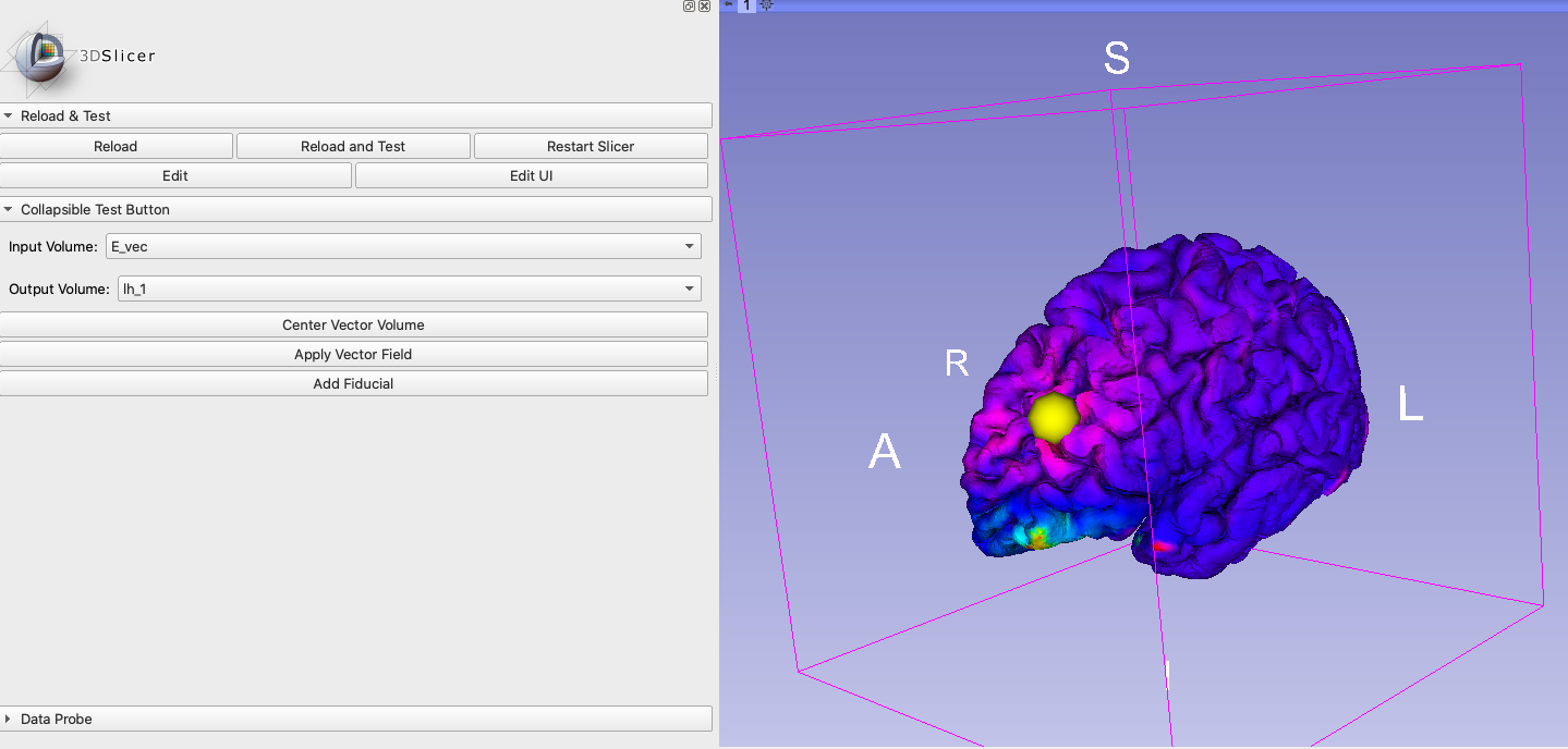 Fiducial (Sphere) moving along brain surface